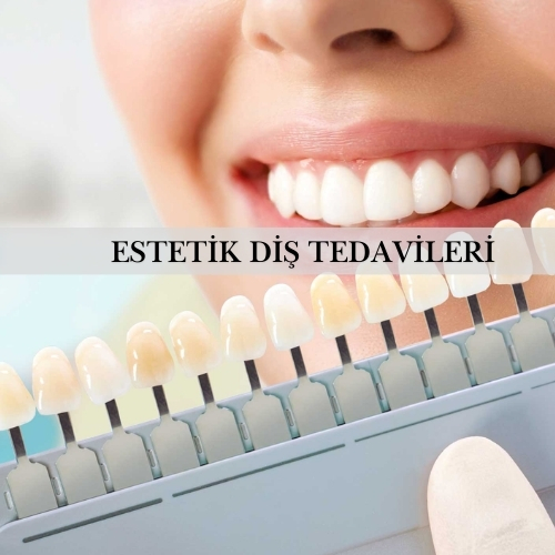 Estetik Diş Tedavileri - Pendik Diş Kliniği